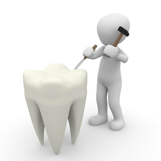 Mediciner.in - Missing Teeth: How to fix this dental issue? | 2025 Dentist