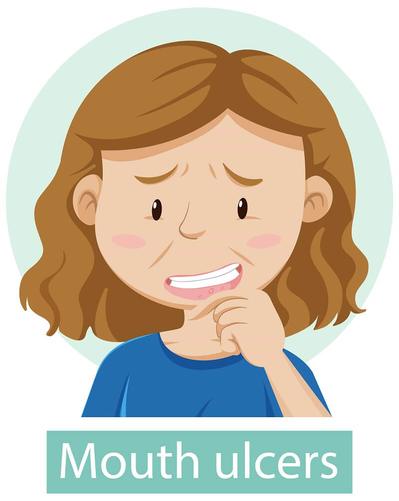 Mediciner.in - Foods that are ulcer busters | 2025 Ulcer Causes
