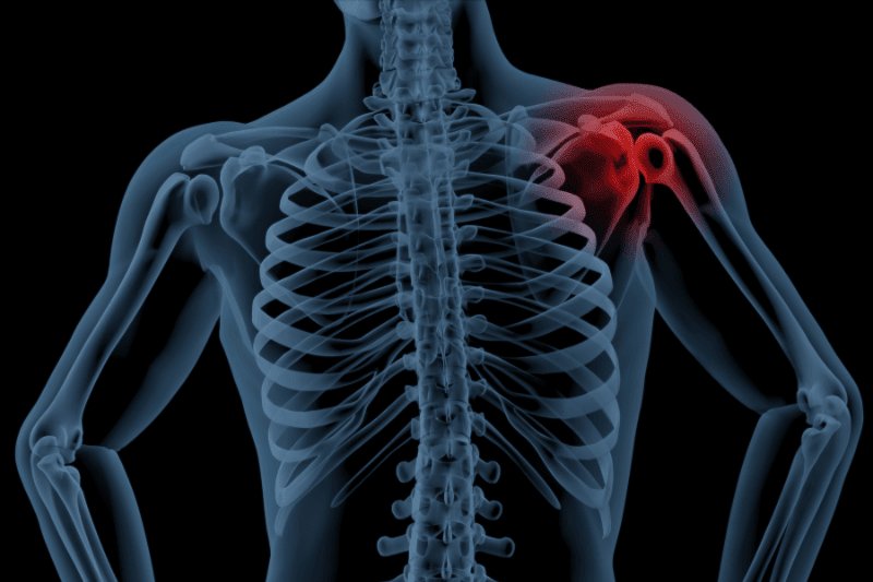 Mediciner.in - Frozen Shoulder | 2025 Shoulder Pain