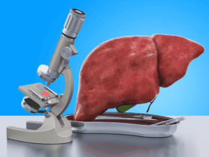 Liver transplants save lives