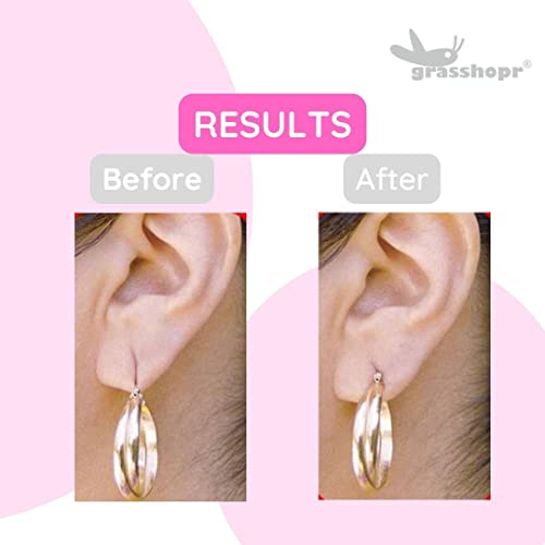 Grasshopr-Ear-Ascension-Invisible-Ear-Lobe-Support-Tape-Pack-of-60-0-1 Grasshopr Ear Ascension Invisible Ear Lobe Support Tape Pack of 60 0 1 2025