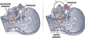 AlexVyan-Genuine-Accessory-Advanced-Tongue-Anti-Snoring-Device-Medical-Silicone-Sleep-Best-Health-Care-Stop-Snoring-Device-Sleep-Now-Snore-Solutions-Device-Snore-Stopper-Relief-Guard-Sleep-Aid-reduces-0-3 AlexVyan Genuine Accessory Advanced Tongue Anti Snoring Device Medical Silicone Sleep Best Health Care Stop Snoring Device Sleep Now Snore Solutions Device Snore Stopper Relief Guard Sleep Aid reduces 0 3 2025