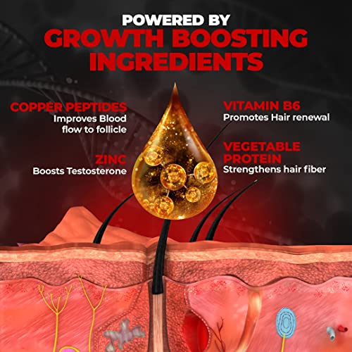 Beardo-Beard-Hair-Growth-Oil-for-thicker-longer-beard-For-patchy-uneven-beard-Beard-Oil-for-fast-beard-growth-Natural-Hair-Oil-50ml-0-2 Beardo Beard Hair Growth Oil for thicker longer beard For patchy uneven beard Beard Oil for fast beard growth Natural Hair Oil 50ml 0 2 2025