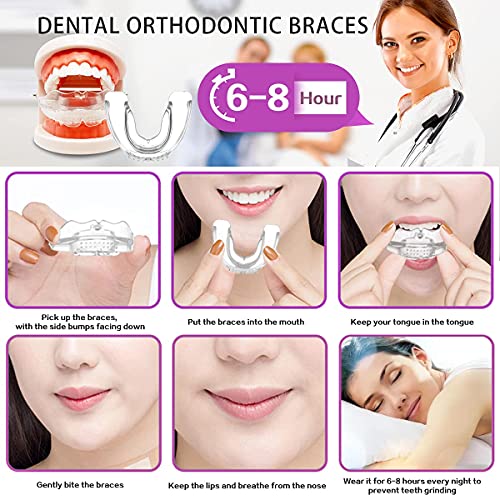 Electomania-Teeth-Aligners-for-Straightening-Teeth-Dental-Orthodontic-Braces-Mouth-Guard-for-Teeth-Grinding-Teeth-Braces-with-Storage-Case-STAGE-D3-Hard-0-1 Electomania Teeth Aligners for Straightening Teeth Dental Orthodontic Braces Mouth Guard for Teeth Grinding Teeth Braces with Storage Case STAGE D3 Hard 0 1 2025