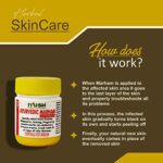 Mediciner.in - IYUSH Herbal Ayurvedic Marham Ointment for Itching, Ring Worms, Eczema, Pregnancy Stretch Marks, Crack Heels & all type Skin Diseases, 25 g Each (Pack of 3) | 2025 IYUSH Herbal Ayurveda IYUSH Ayurvedic Marham Ointment for Itching Ring Worms Eczema Pregnancy Stretch Marks Crack Heels and All Type Skin Diseases 25 g Each Pack of 3 0 2 2025