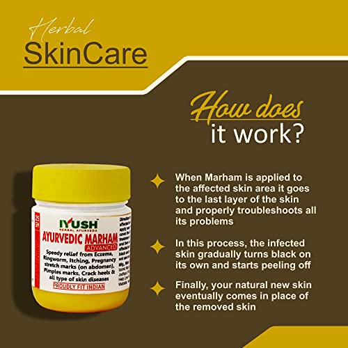 IYUSH-Herbal-Ayurveda-IYUSH-Ayurvedic-Marham-Ointment-for-Itching-Ring-Worms-Eczema-Pregnancy-Stretch-Marks-Crack-Heels-and-All-Type-Skin-Diseases-25-g-Each-Pack-of-3-0-2 IYUSH Herbal Ayurveda IYUSH Ayurvedic Marham Ointment for Itching Ring Worms Eczema Pregnancy Stretch Marks Crack Heels and All Type Skin Diseases 25 g Each Pack of 3 0 2 2025